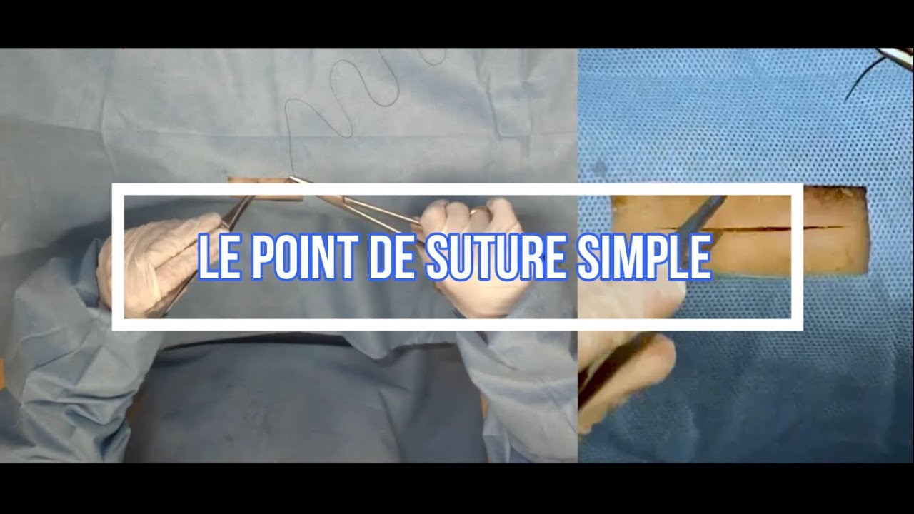 Le point de suture simple : technique de suture