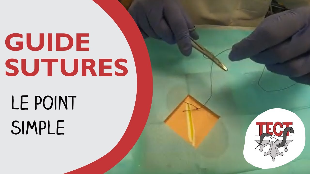 [2023] Guide suture | Le point simple